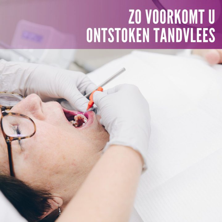 Zo voorkomt u ontstoken tandvlees!